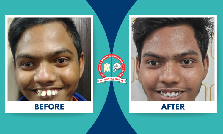 braces treatment at dr tayyeb's